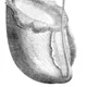 Pitcher plant